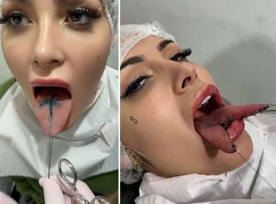 QUE CHOCANTE: Andressa Urach C0rta Sua Língua Ao Mei0 Para Dar Mais Prazer Em Vídeos Com Seu Filh…Ver Mais