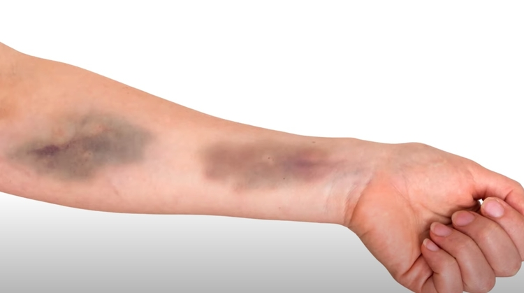 Fique atento aos 8 sinais, que o corpo avisa que pode estar com um câncer… Ver mais