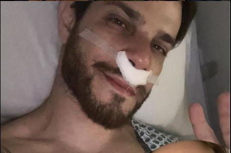 Ele Pensava Que Era Uma Espinha N0 Nariz, Quando Apertou Saiu Pedaço De Um…Ver mais