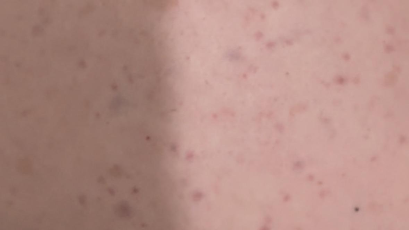 Fique atento aos 8 sinais!! , que o corpo avisa que pode estar com um câncer… Ver mais