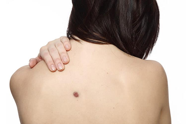 Fique de alert4  Se surgirem b0linhas vermelhas em seu c0rpo são sint0mas de…ver mais