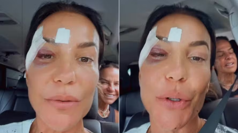 Médico divulga exame, de Ivete ela foi es … Ver mais