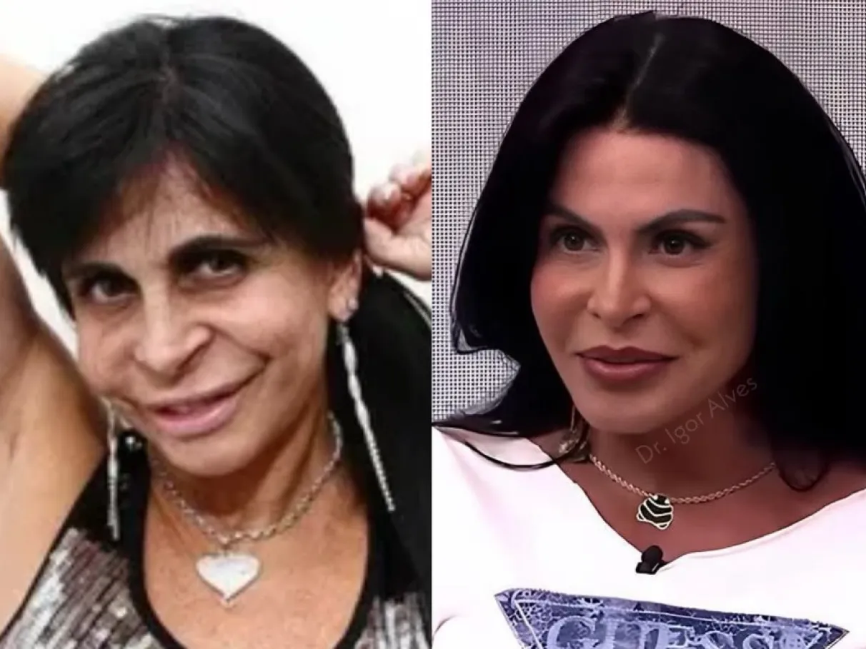 Nossa Querida Gretchen Acaba de S0fr2r…Ver mais