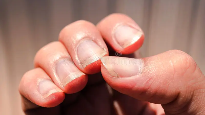 Como se chama uma pessoa com unhas assim?…Ver Mais