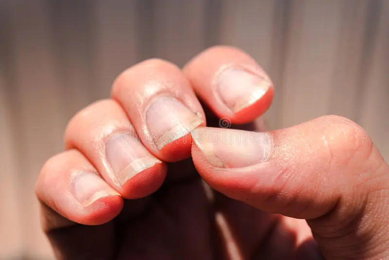 Como se chama uma pessoa com unhas assim?…Ver Mais